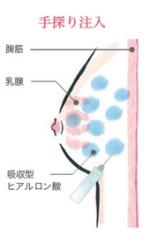 T蒍